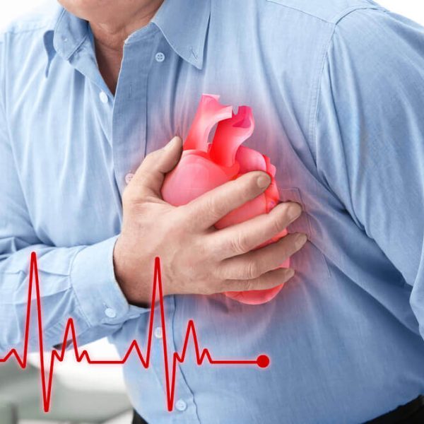 Heart attack